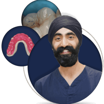 Mastering the basics of occlusion in everyday general dentistry