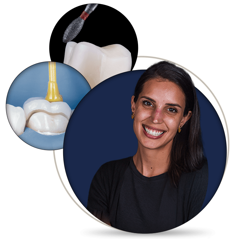Posterior Adhesive Restorations: The Biomimetic Approach