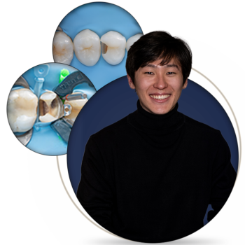 Class II Direct Restorations: Predictability in Everyday Practice - Prodentists.org
