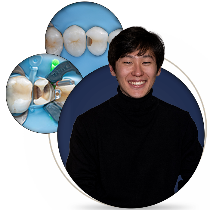 Class II Direct Restorations: Predictability in Everyday Practice - Prodentists.org