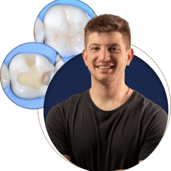 Posterior Composites Made Simple: Master Anatomy That Works
